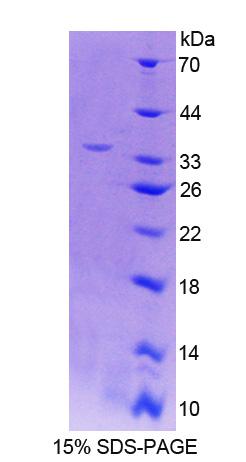 Recombinant Carboxylesterase 1 (CES1)