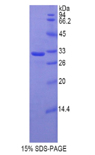 Recombinant Hyaluronan Synthase 1 (HAS1)