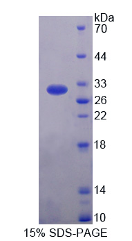 Recombinant Huntingtin Interacting Protein 1 Related Protein (HIP1R)