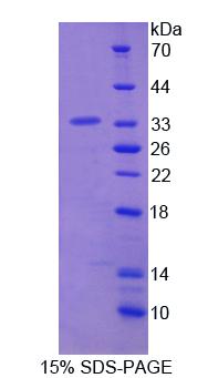 Recombinant Lymphocyte Specific Protein 1 (LSP1)