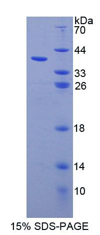 Recombinant Ubiquitin Associated Protein 1 (UBAP1)