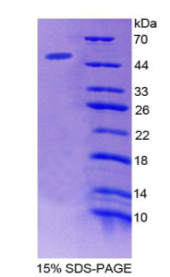 Recombinant Microfibrillar Associated Protein 2 (MFAP2)