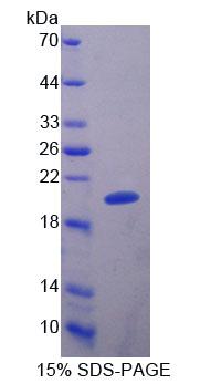 Recombinant Mitochondrial Ribosomal Protein L1 (MRPL1)