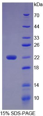 Recombinant Microseminoprotein Beta (MSMb)