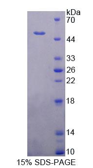 Recombinant Pseudouridylate Synthase 1 (PUS1)