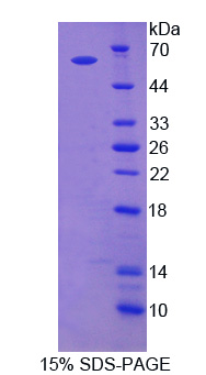 Recombinant Adenylyl Cyclase Associated Protein 2 (CAP2)