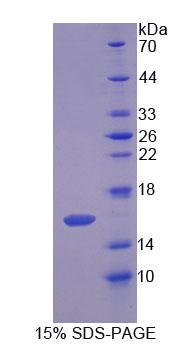 Recombinant Sterol Carrier Protein 2 (SCP2)