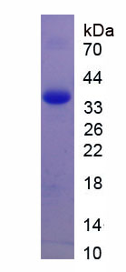 Recombinant Stabilin 1 (STAB1)