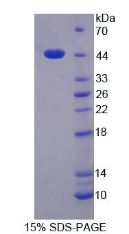 Recombinant Gamma-Aminobutyric Acid B Receptor 1 (gABBR1)