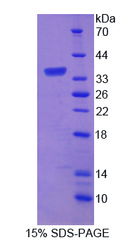 Recombinant Amyloid Beta Precursor Protein Binding Protein B3 (APBB3)