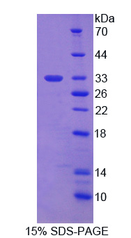 Recombinant Carcinoembryonic Antigen Related Cell Adhesion Molecule 1 (CEACAM1)