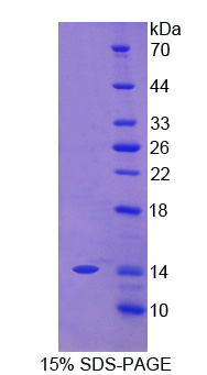 Recombinant Carcinoembryonic Antigen Related Cell Adhesion Molecule 7 (CEACAM7)