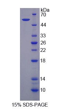 Recombinant Phenylalanyl tRNA Synthetase 2, Mitochondrial (FARS2)
