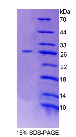 Recombinant Low Density Lipoprotein Receptor Related Protein 1B (LRP1B)