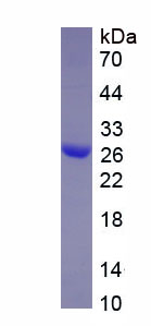 Recombinant Collagen Type III Alpha 1 (COL3a1)
