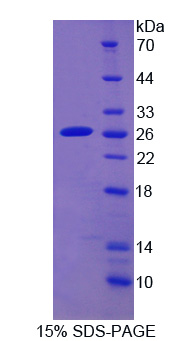 Recombinant Cytochrome P450 2D6 (CYP2D6)