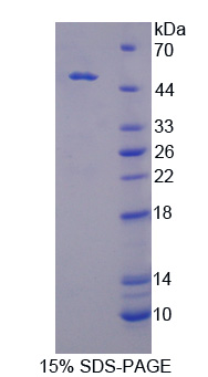Recombinant Casein Kinase 1 Delta (CSNK1d)