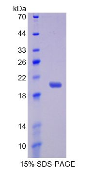 Recombinant Interleukin 17 Receptor B (IL17RB)