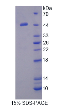 Recombinant Protein C Inhibitor (PCI)