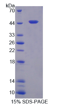 Recombinant Dickkopf Related Protein 3 (DKK3)