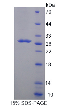 Recombinant Cytochrome P450 24A1 (CYP24A1)