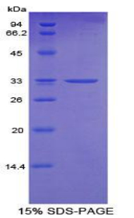 Recombinant Cytochrome P450 24A1 (CYP24A1)