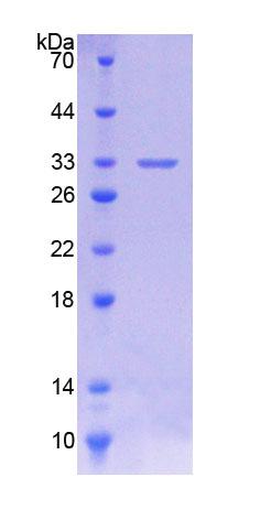 Recombinant Cytochrome P450 11A1 (CYP11A1)