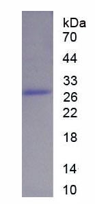 Recombinant Mitogen Activated Protein Kinase Kinase Kinase 12 (MAP3K12)