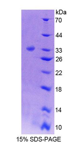 Recombinant Protein Tyrosine Phosphatase, Non Receptor Type 5 (PTPN5)