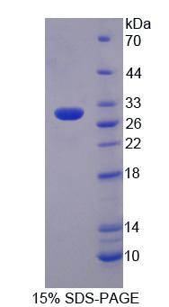 Recombinant Protein Tyrosine Phosphatase Receptor Type N2 (PTPRN2)