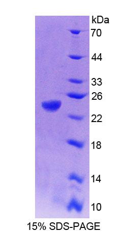 Recombinant Protein Tyrosine Phosphatase Type IVA 1 (PTP4A1)