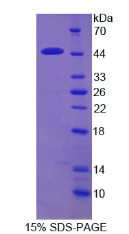 Recombinant Acetyl Coenzyme A Acetyltransferase 2 (ACAT2)