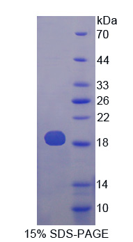 Recombinant Phospholipase A2, Group X (PLA2G10)