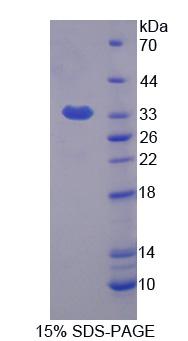 Recombinant Phospholipase C Delta 4 (PLCd4)