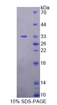 Recombinant Branched Chain Aminotransferase 2, Mitochondrial (BCAT2)