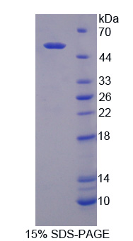 Recombinant Dipeptidyl Peptidase 7 (DPP7)