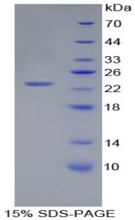 Recombinant Peptidoglycan Recognition Protein 1 (PGLYRP1)