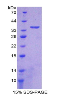 Recombinant 5'-Nucleotidase, Cytosolic III (NT5C3)