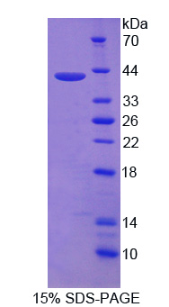 Recombinant Nuclear Receptor Related Protein 1 (NURR1)