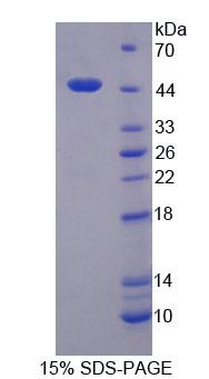Recombinant Lemur Tyrosine Kinase 3 (LMTK3)