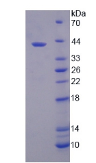 Recombinant Solute Carrier Family 39, Member 6 (SLC39A6)
