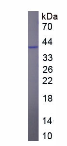 Recombinant Receptor Interacting Serine Threonine Kinase 1 (RIPK1)