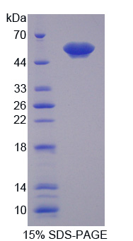 Recombinant Annexin A11 (ANXA11)