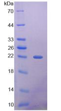 Recombinant Histone Deacetylase 4 (HDAC4)
