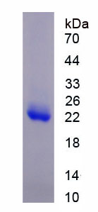 Recombinant Histone Deacetylase 6 (HDAC6)