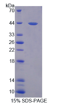 Recombinant Ring Finger Protein 55 (RNF55)