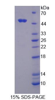 Recombinant Ring Finger Protein 39 (RNF39)