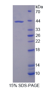 Recombinant Ubiquitin Specific Peptidase 8 (USP8)