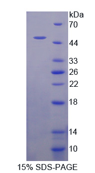 Recombinant Tight Junction Protein 2 (TJP2)