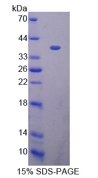 Recombinant Breast Carcinoma Amplified Sequence 3 (BCAS3)